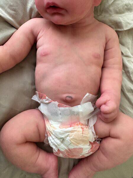 Baby Shyla